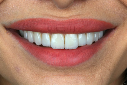 Adsız tasarım - 10