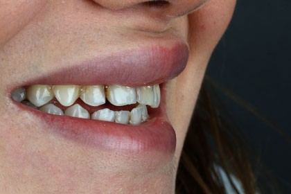 Adsız tasarım – 13 Adsız tasarım - 13