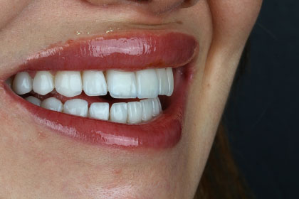 Adsız tasarım - 14